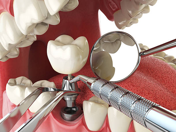 Best Emergency Dental Surgery in Ford Heights, IL